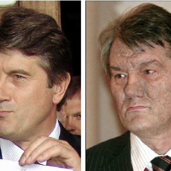 President-Viktor-Yushchenko-of-Ukraine-before-and-after-dioxin-poisoning-with_Q640.jpg